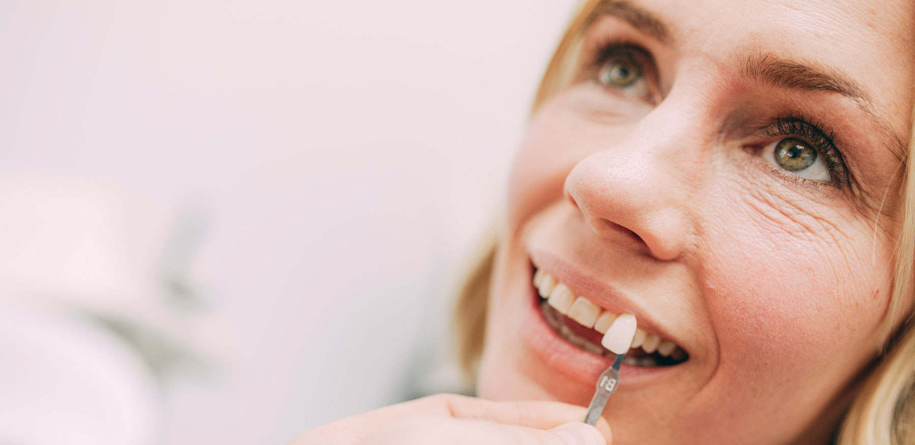 Zahnfarbe für ästhetischen Zahnersatz in Frankfurt wird angepasst.